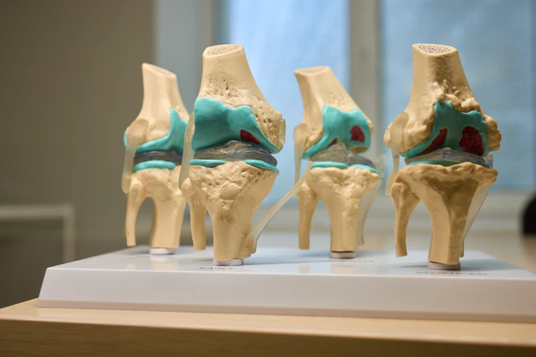 Four knee joint models.