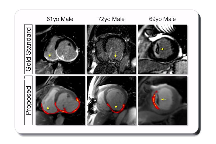 Middle Sicknesses: Day after today, develop into the prognosis due to MRI in colours 1 The new generation of MRI Cardiac imaging photos, improved color. Pictures collected in Cha De Bordoauk