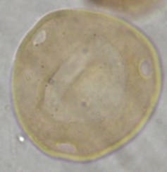 A round pollen grain shown under a microscope.