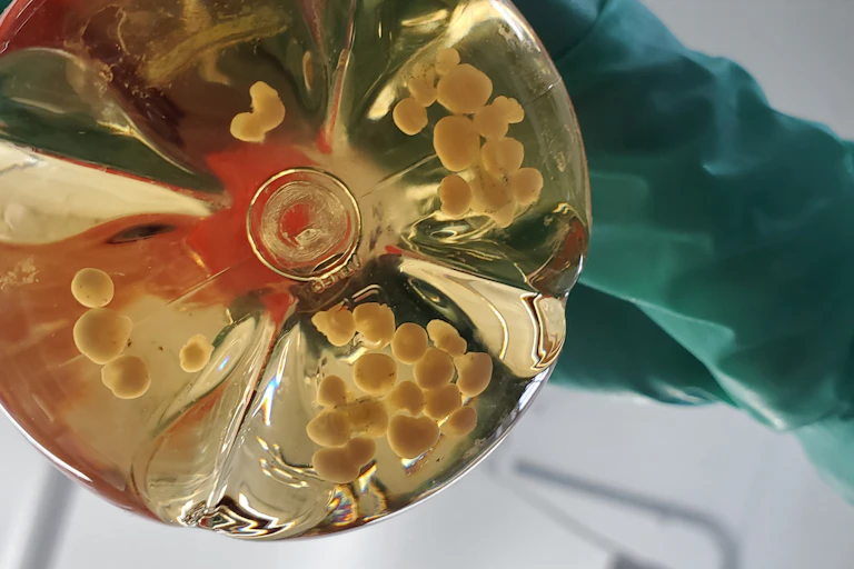 Gloved hand holding up the bottom of a glass container with small round blobs floating in it