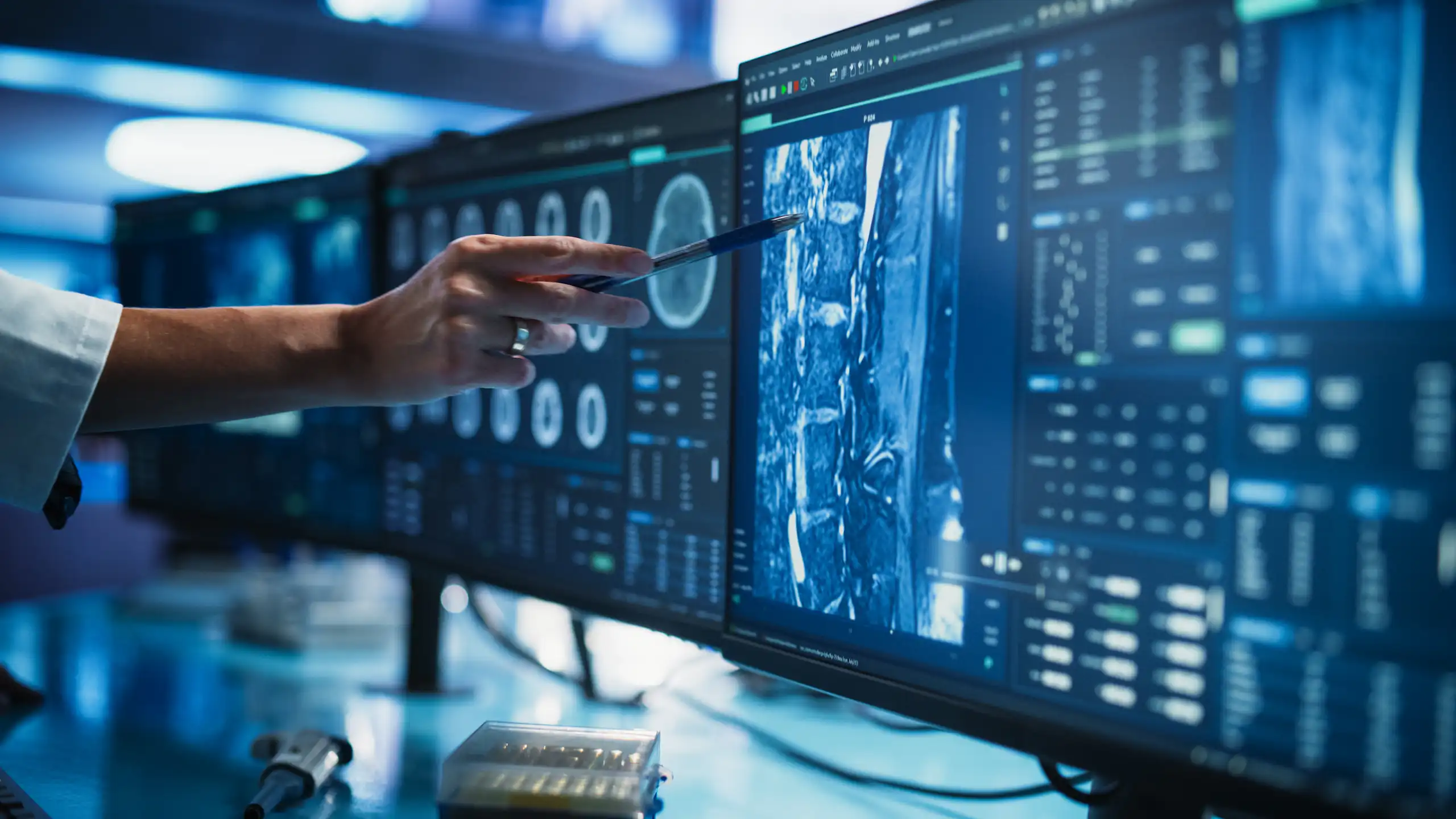 Médico señalando a una imagen médica en una pantalla