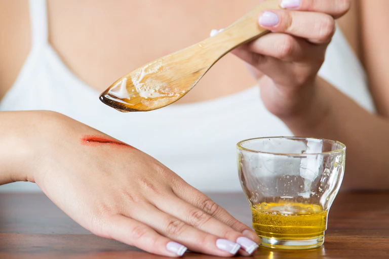Close up of woman applying honey to a wound