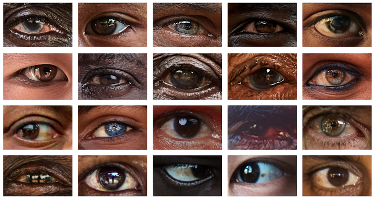 White of the eyes isn't a homogeneous feature in a human being, in step with the learn about 3 file 20250515 56 oh9d6r.png?ixlib=rb 4.1