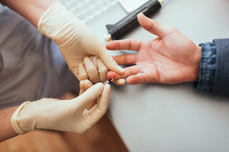 Skin prick test