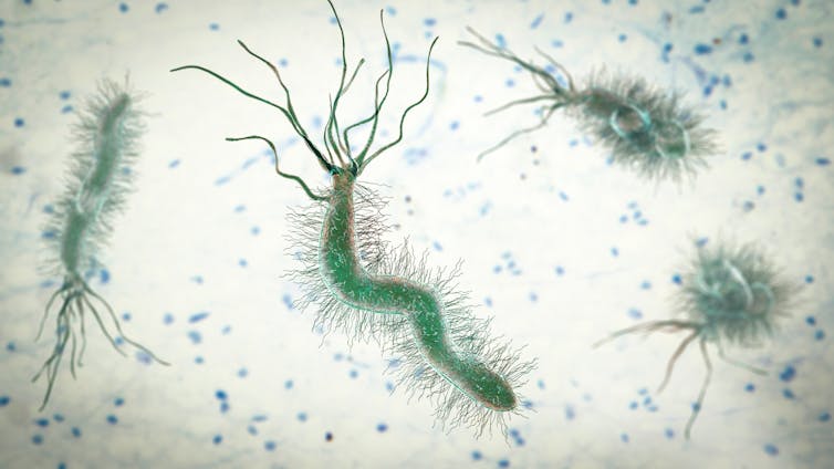 Recreación de la bacteria _Helicobacter pylori_.