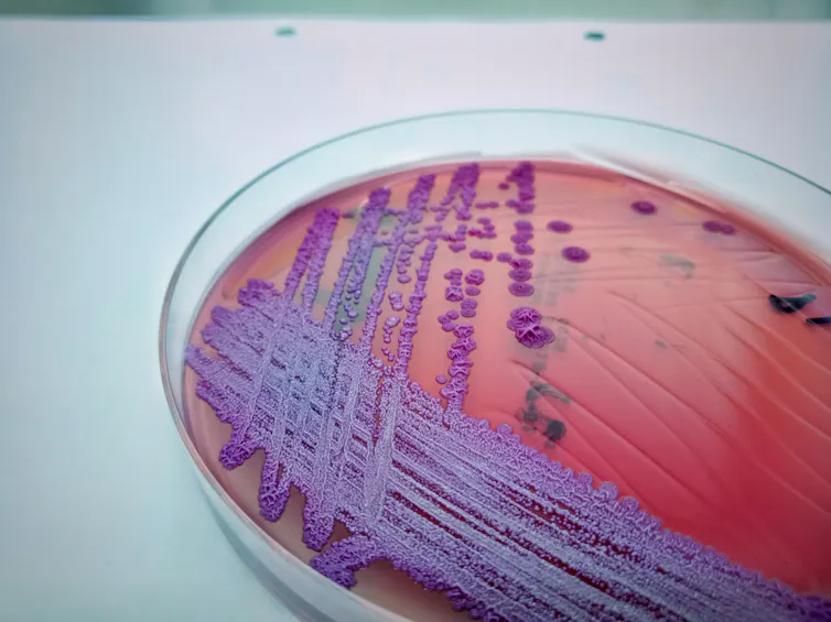 The _B. pseudomallei_ in a petri dish – purple spores on a red background.