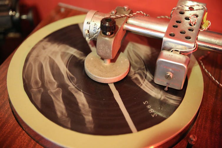 X-ray negative of hand bones cut into a circle, being pressed by a metal device.