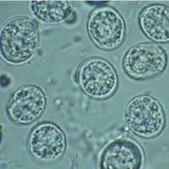 Microscopy image of translucent, two-layers circular blobs