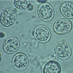 Microscopy image of translucent, two-layers circular blobs