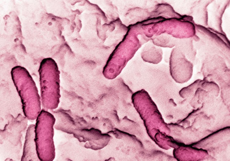 We discovered a germ that ‘feeds’ on clinic plastic – new find out about 1 Electron micrograph of Pseudomonas aeruginosa.