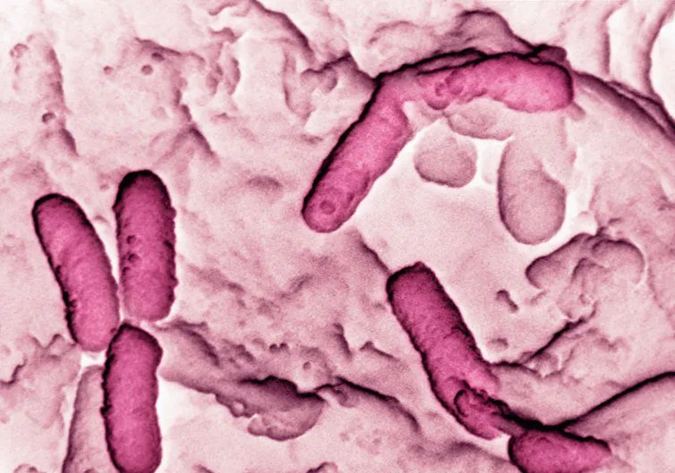 Electron micrograph of Pseudomonas aeruginosa.