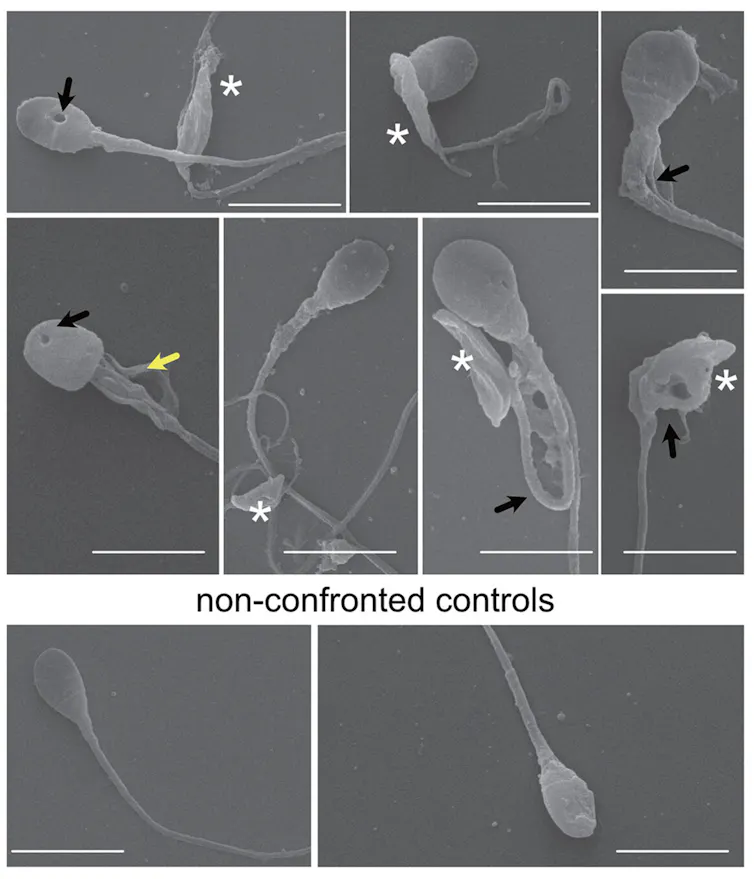 Series of microscopy images of slightly deformed sperm with holes in their heads
