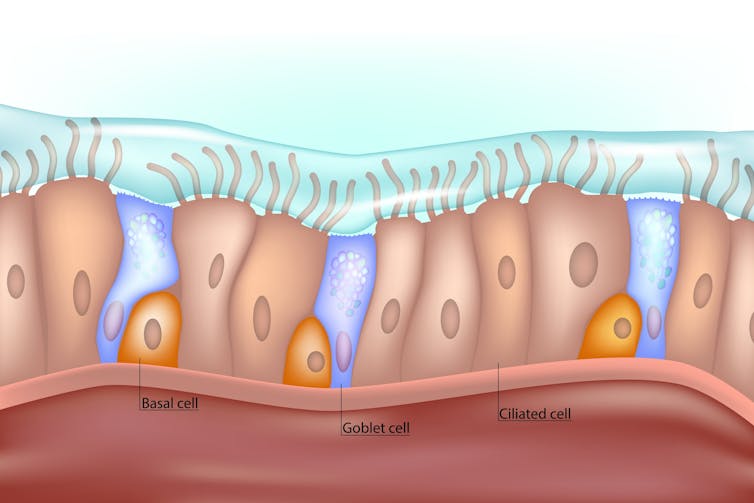 Diagram of tiny hairs (cilia) in the airways that waft phlegm