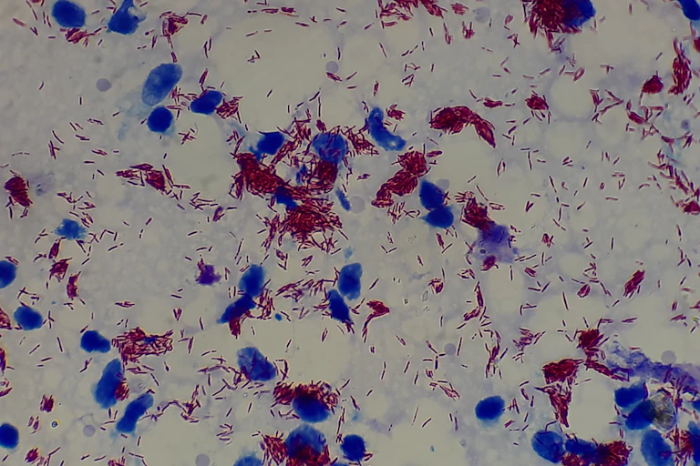 Mycobacterium leprae à un grossissement de 2000X.