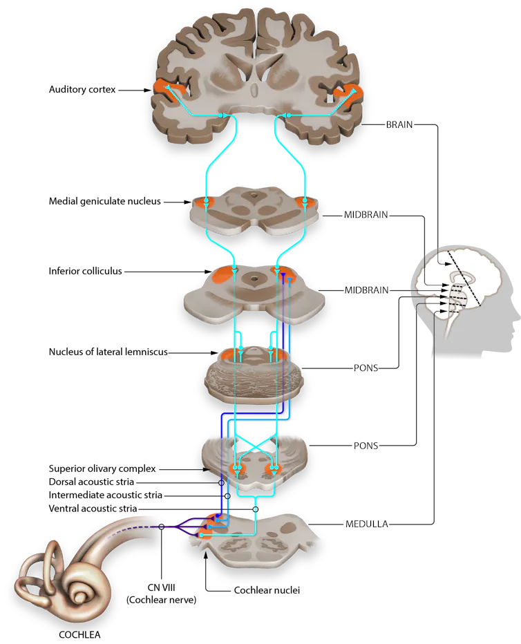 Diagram tracing auditory pathway from the cochlea and through cross-sections of the brain to the auditory cortex