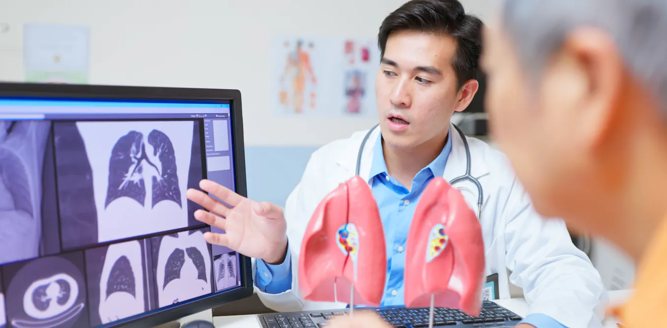 Lung cancer screening hopes to save lives. But we also need to watch for possible harms Lung cancer screening hopes to save lives. But we also need to watch for possible harms