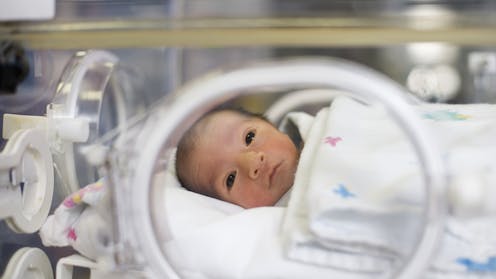 Premature babies are given sucrose for pain relief – but new research shows it doesn’t stop long-term impacts on development