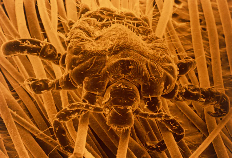 A picture of a pubic louse.
