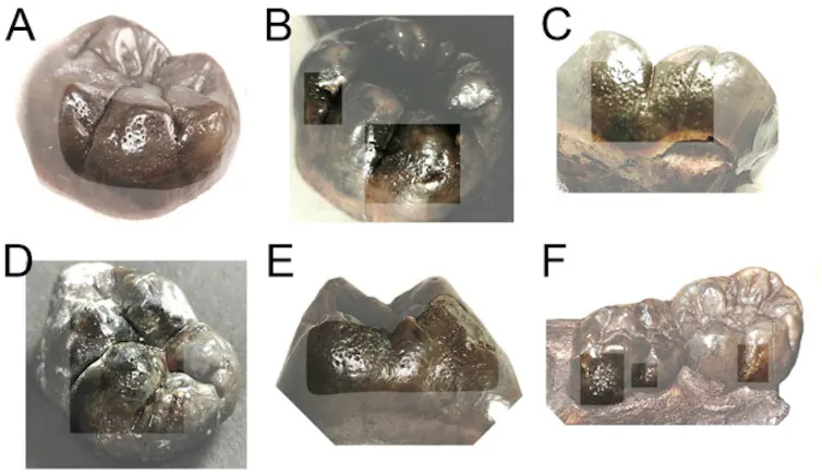 Photos of six teeth with uniform pitting.