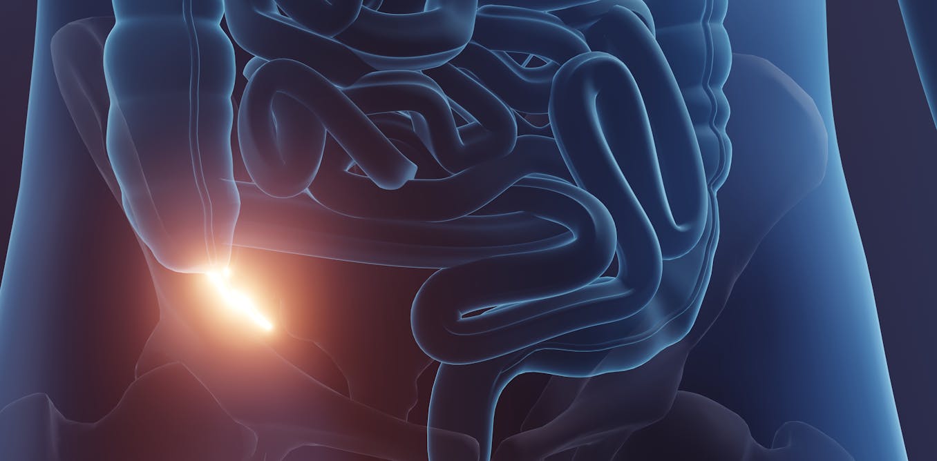 Why the appendix is much more important than we once thought