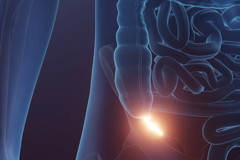Imagen médica de un apéndice iluminado