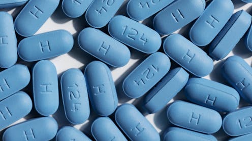 We have drugs to manage HIV. So why are we spending millions looking for cures?