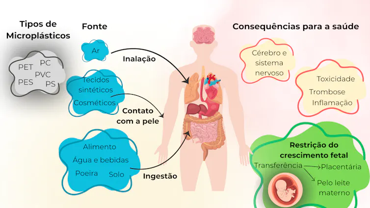Microplásticos: tipos, fontes, vias de entrada no organismo humano e seus possíveis impactos na saúde.