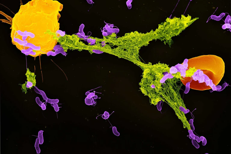 Yellow blob emanating green threads trapping thin purple blobs and one red blob