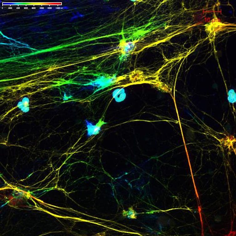 Microscopy image of long threads extending from round blobs
