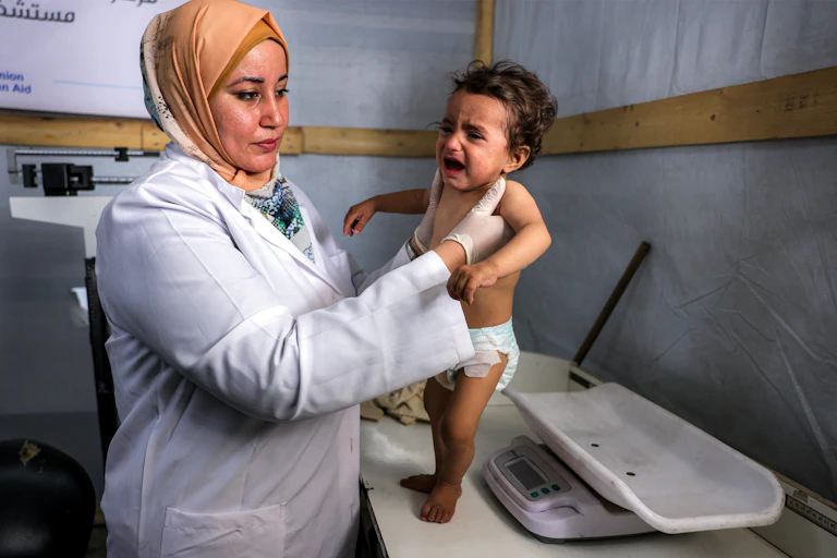 Un nourrisson palestinien d'un an souffrant de malnutrition est mesurée alors qu'il reçoit un traitement à l'hôpital Kamal Adwan de Beit Lahia, dans le nord de la bande de Gaza, le 24 avril 2025.