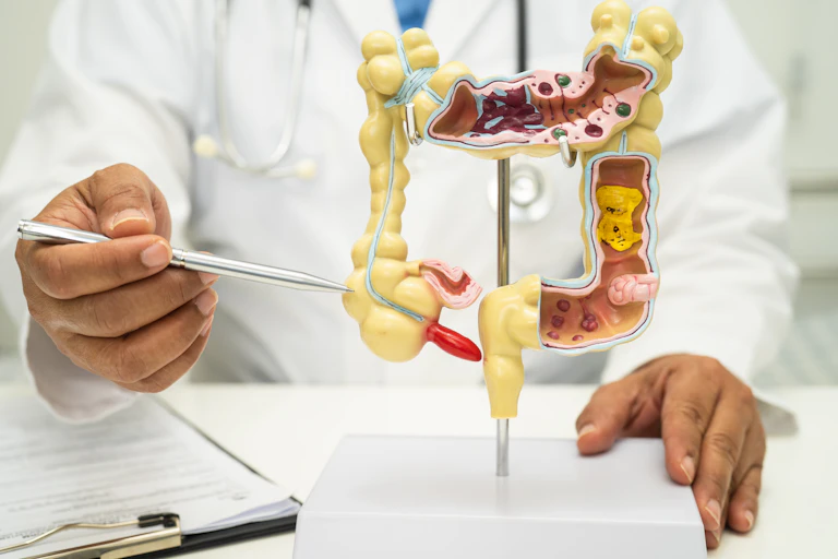 Um médico aponta para o apêndice em um modelo de anatomia plástica.
