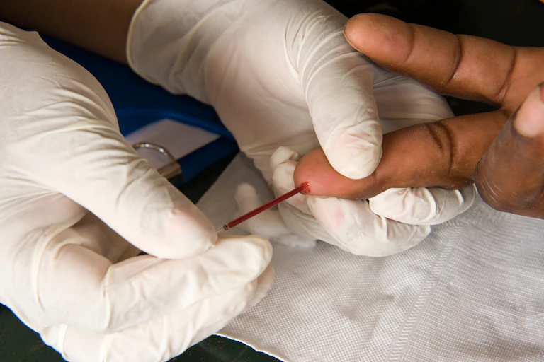 Taking a blood sample for an HIV test.