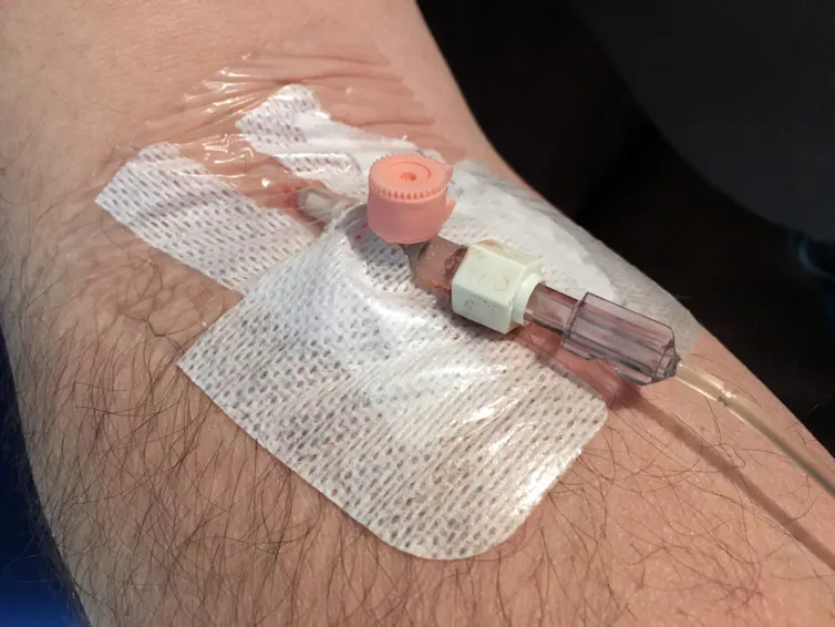 A person with a canula in their arm.