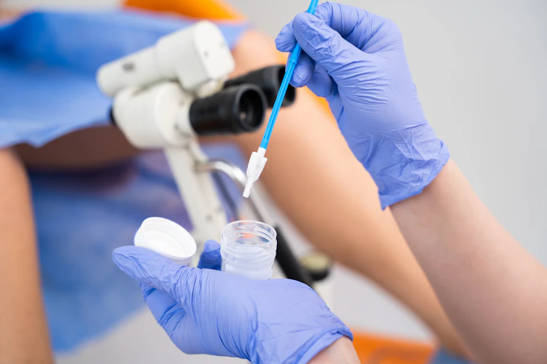 Close-up of a medical professional using a pipette and sample container during a gynecological examination with colposcopy equipment in the background.