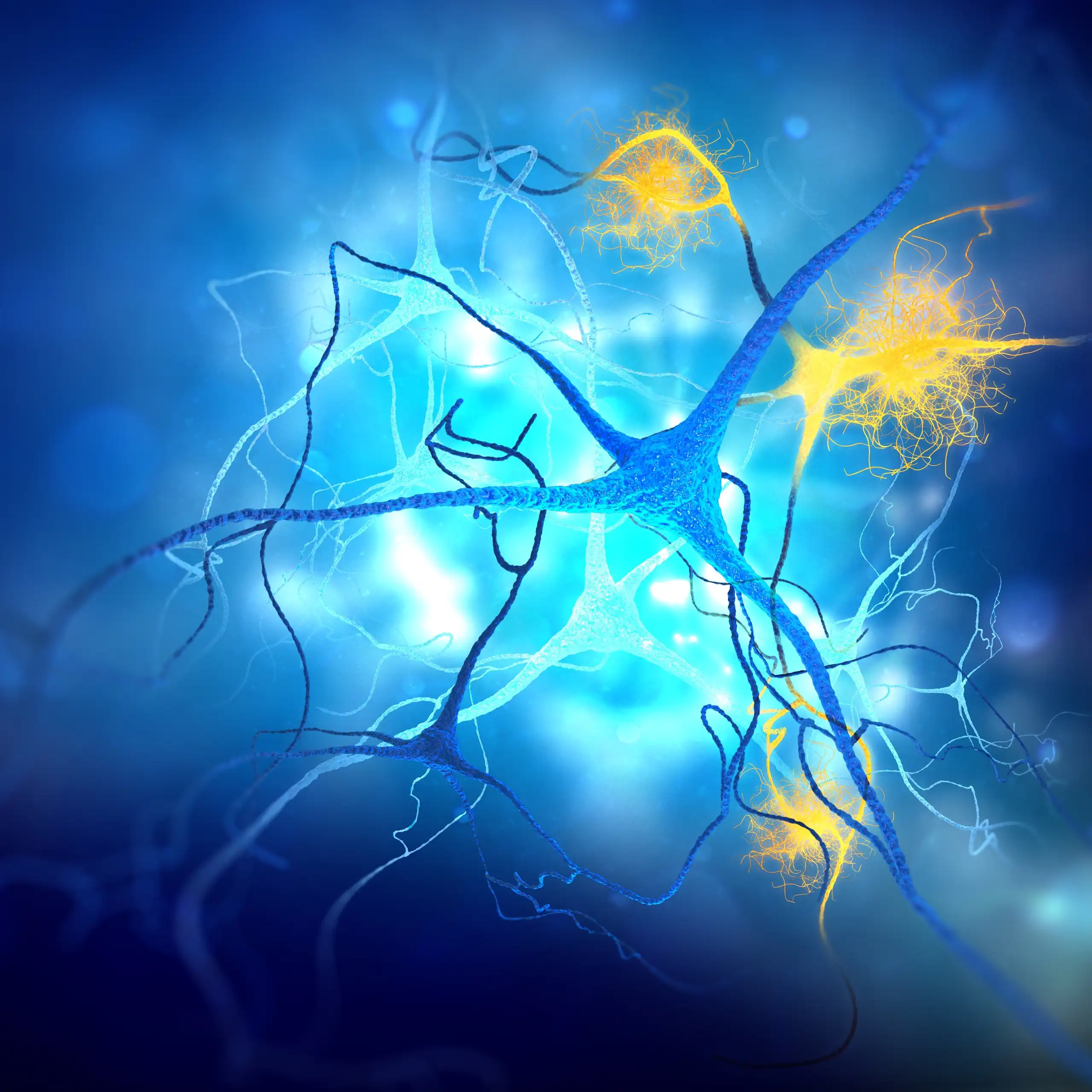 Illustration en 3D de neurones endommagés par la maladie d’Alzheimer