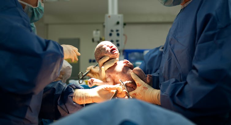 Holded into the hands of a newborn doctor.
