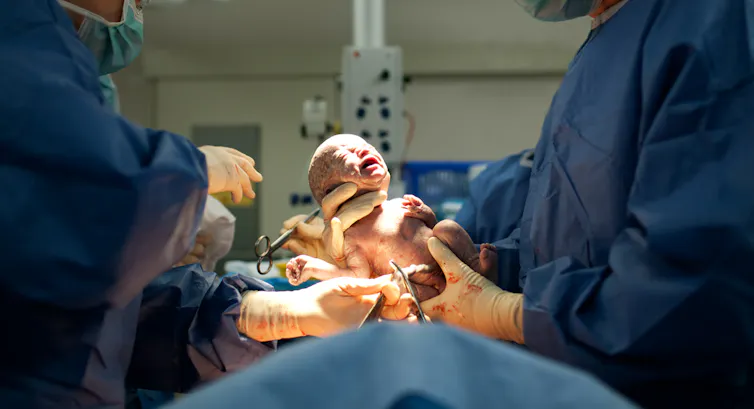 A newborn held in a doctor's hands.