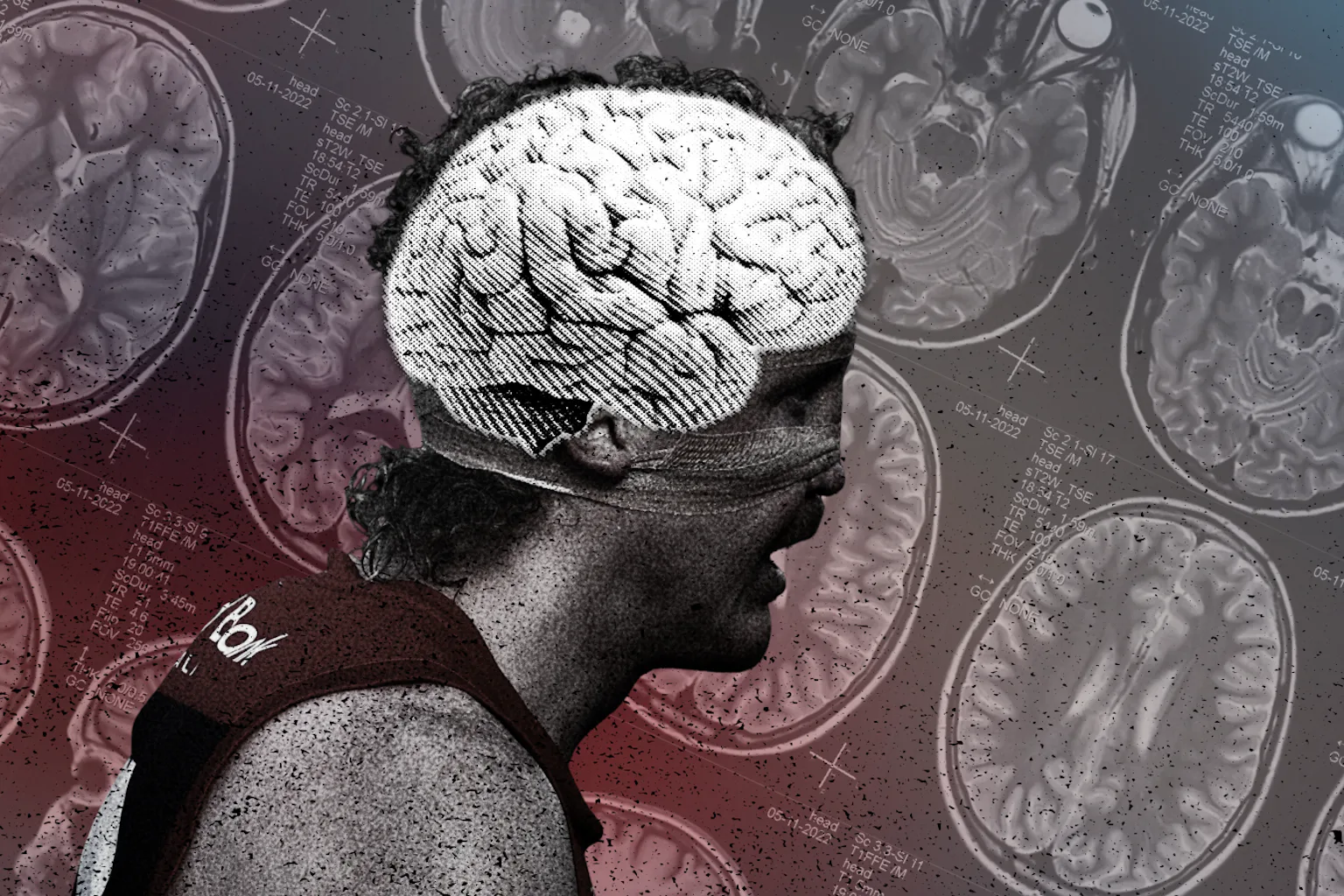 I’ve seen the brain damage contact sports can cause – we all need to ...