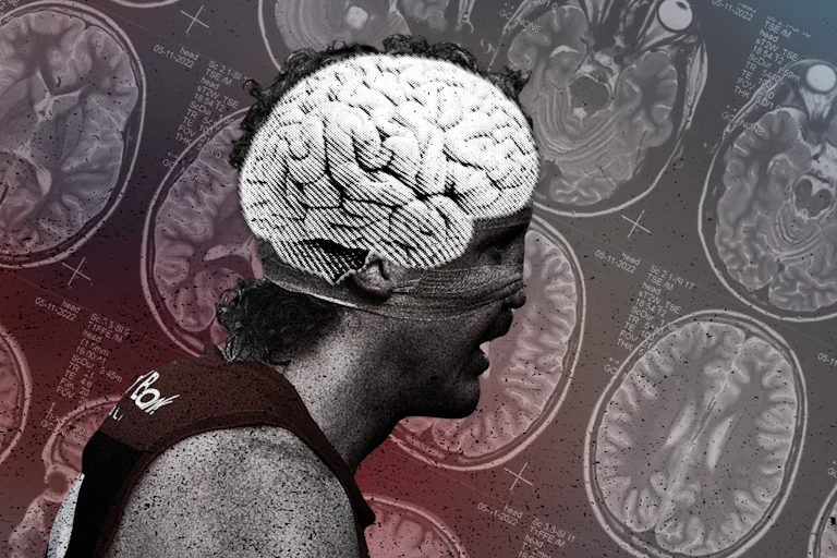 An overlayed image shows an AFL player with his brain highlighted, while in the background are MRI images of brains,