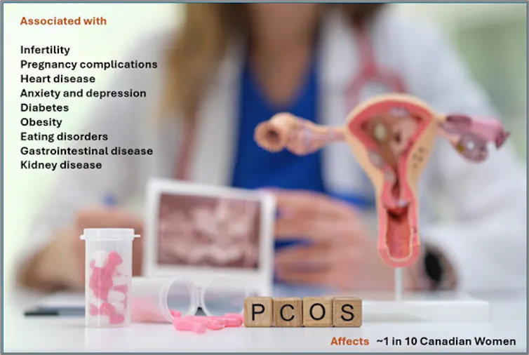 A model of a uterus and ovaries in the foreground with tiles spelling PCOS, and a woman in a white coat blurred in the background