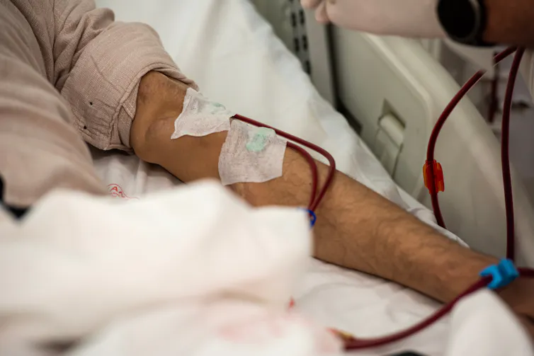 A close up of an arm receiving kidney dialysis.
