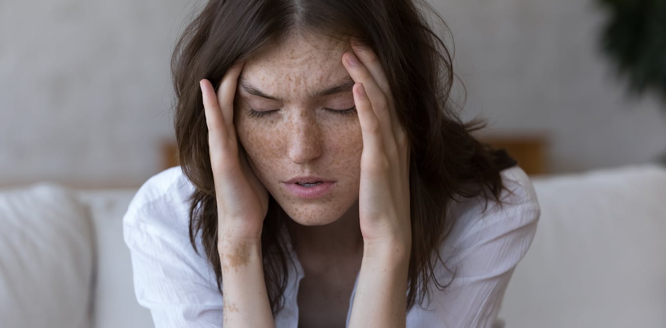 How weather changes cause migraines – a neurologist explains the triggers and what you can do to ease the pain How weather changes cause migraines – a neurologist explains the triggers and what you can do to ease the pain