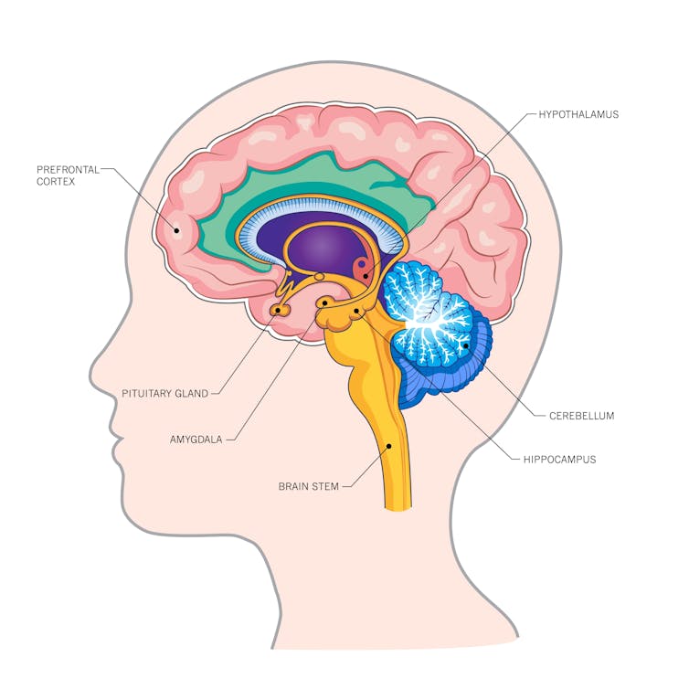 Brain graphic showing the amygdala and prefrontal cortex
