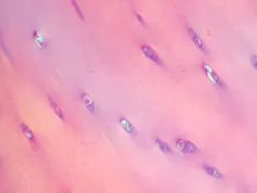 Imágenes de condrocitos (células) al microscopio