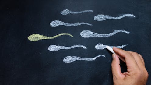 What’s the difference between sperm and semen? And can pre-ejaculate get you pregnant?