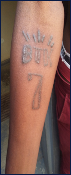 A human arm displaying an image on it with rising welts of flesh forming the letters BTK and the number 7 with sunbeams radiating from the top.