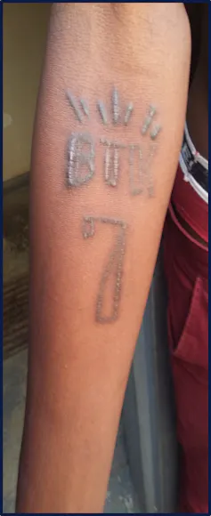 A human arm displaying an image on it with rising welts of flesh forming the letters BTK and the number 7 with sunbeams radiating from the top.
