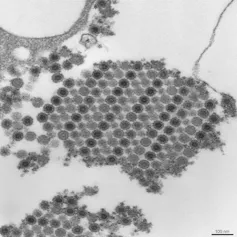 Micrographie électronique à transmission (TEM) représentant de nombreuses particules du virus chikungunya, composées d’un noyau central dense entouré d’une enveloppe virale. Chaque virion a un diamètre d’environ 50 nm.