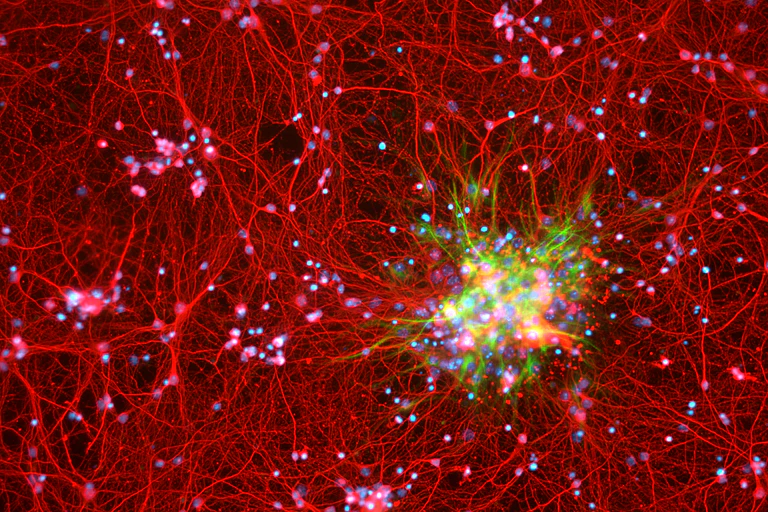 Les astrocytes, ici en vert, au milieu des neurones en rouge, sont un type de cellules présentes dans le cerveau.