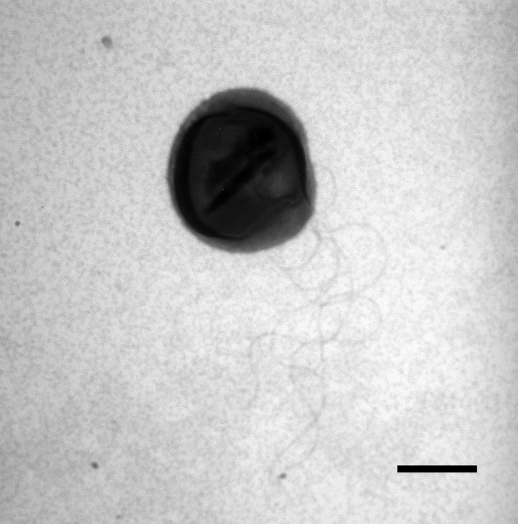 A microscope image of a microbe, which looks like a big, circular dot.